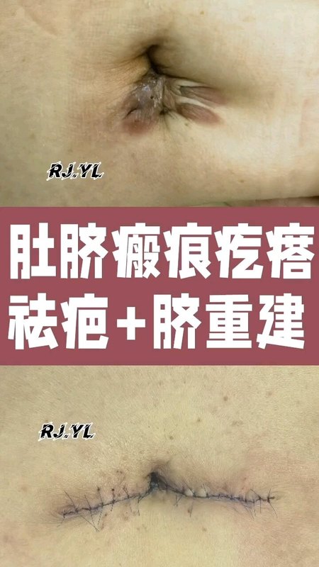 視頻封面