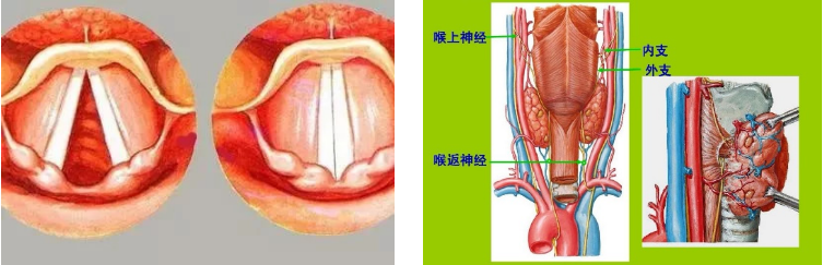 圖文圖片