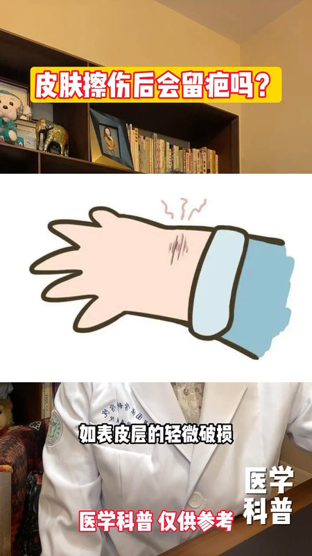 視頻封面