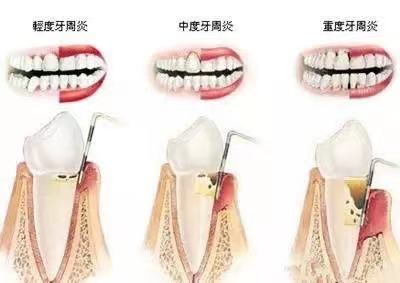 圖文圖片