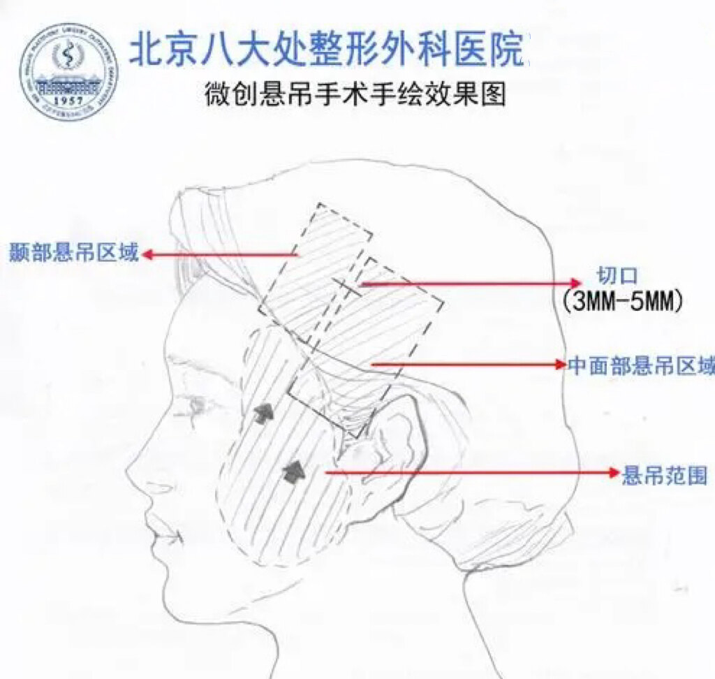 圖文圖片