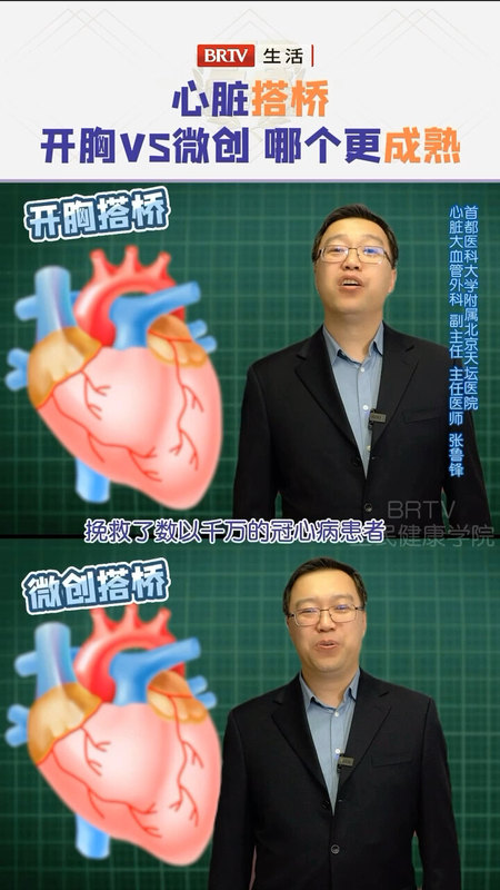 心脏冠脉搭桥，微创搭桥与开胸搭桥，那个更成熟呢？BRTV全民健康学院节目有答案。
