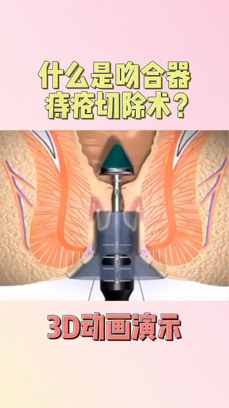 北京市肛肠医院医院排队代办挂号覆盖北京全三甲的简单介绍 北京市肛肠医院医院排队代办挂号覆盖北京全三甲的简单介绍