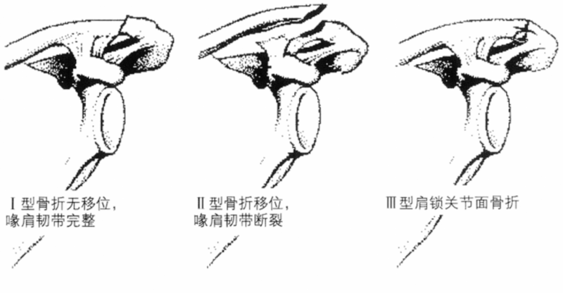 圖文圖片