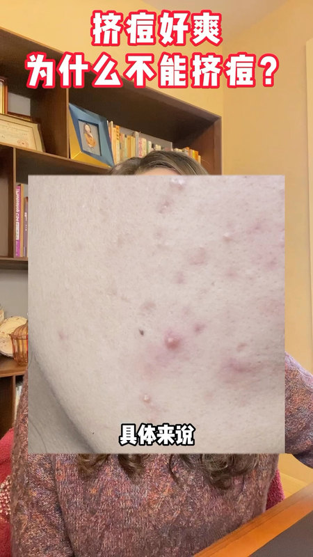 視頻封面