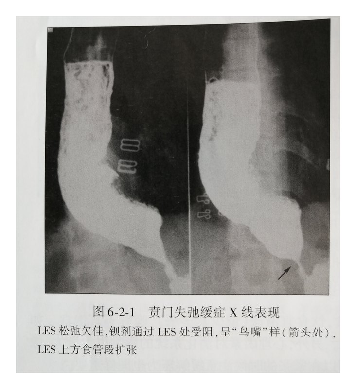 圖文圖片