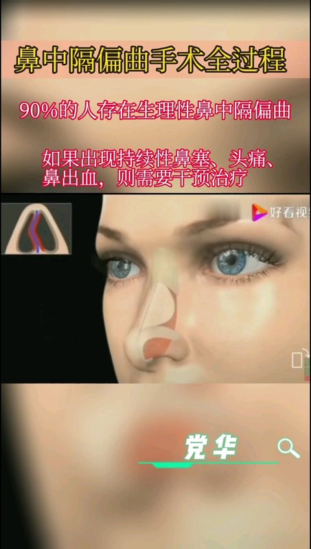 視頻封面