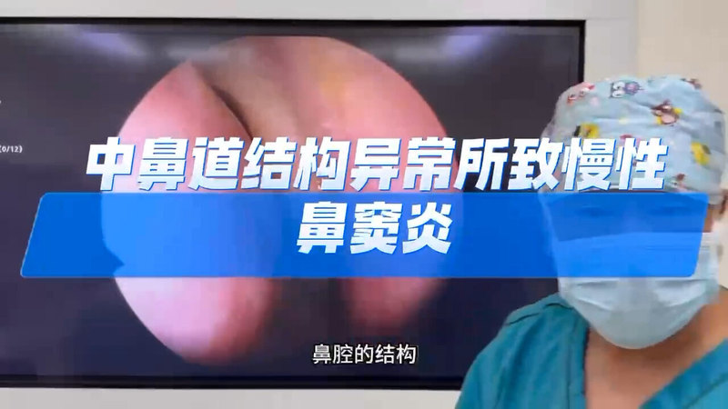 鼻腔结构异常所致鼻窦疾病