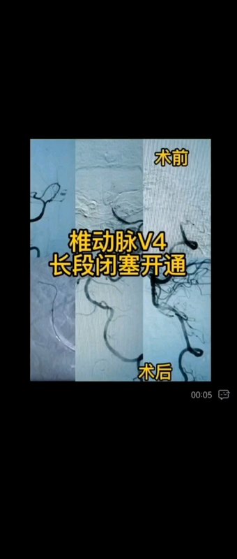 視頻封面