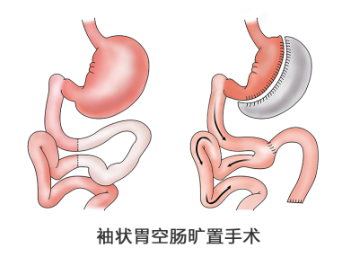 圖文圖片