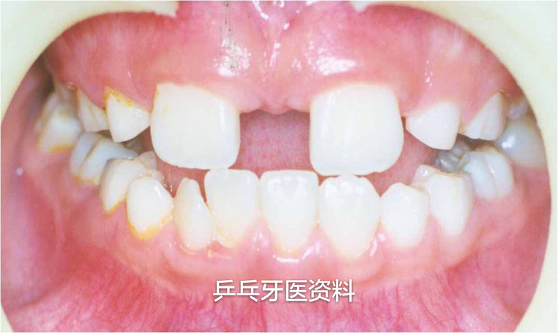圖文圖片