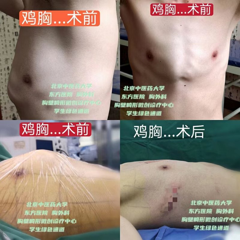圖文圖片