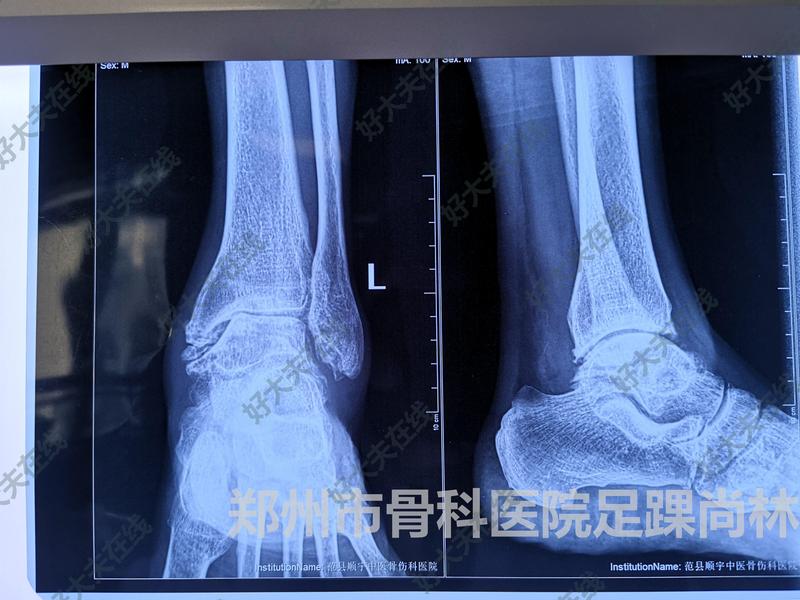 圖文圖片