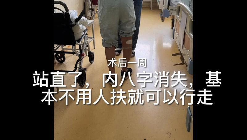 显微外科技术下的功能重建手术助力17岁脑瘫少女圆了直立行走梦，她会越走越好！