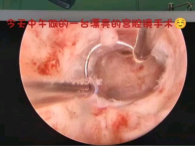 視頻封面