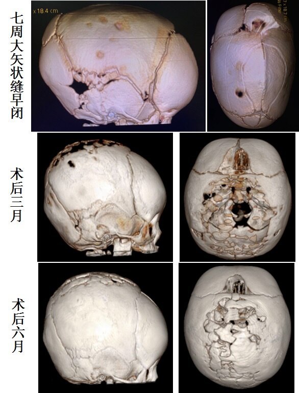 圖文圖片