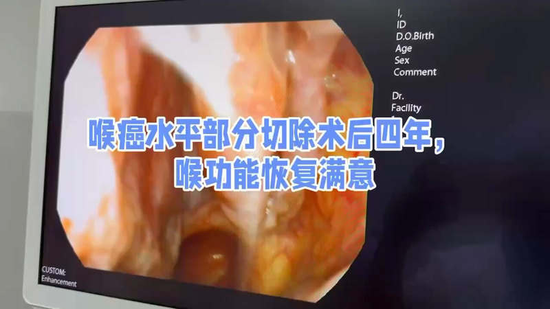 視頻封面
