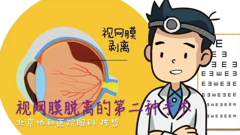 視頻封面
