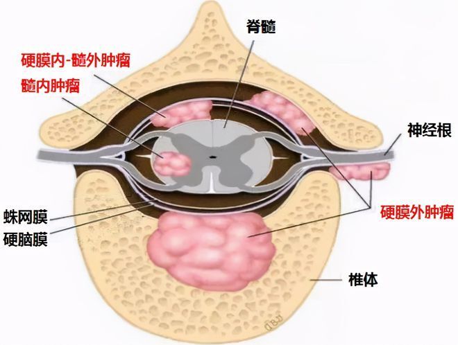 圖文圖片