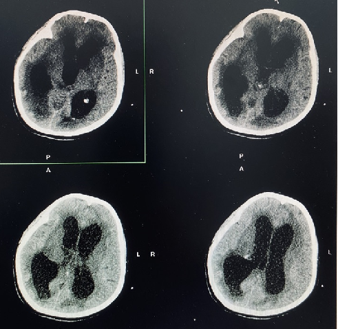 宣武医院穿刺预约-宣武医院预约取号时间 