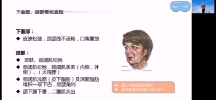 視頻封面
