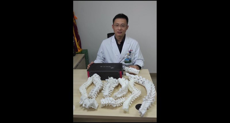 为什么复杂脊柱畸形手术要做脊柱3D打印（上）？