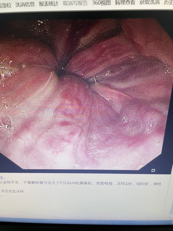 圖文圖片