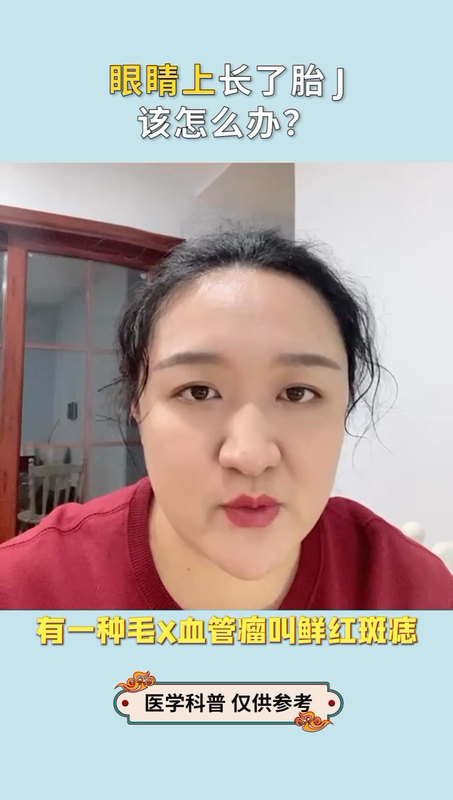 眼周的胎记怎么处理