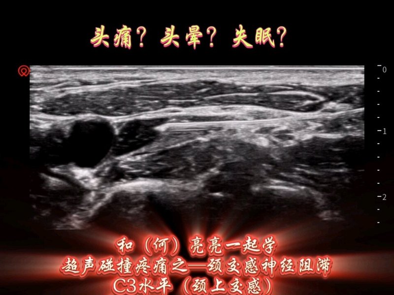 头痛、失眠，来试试