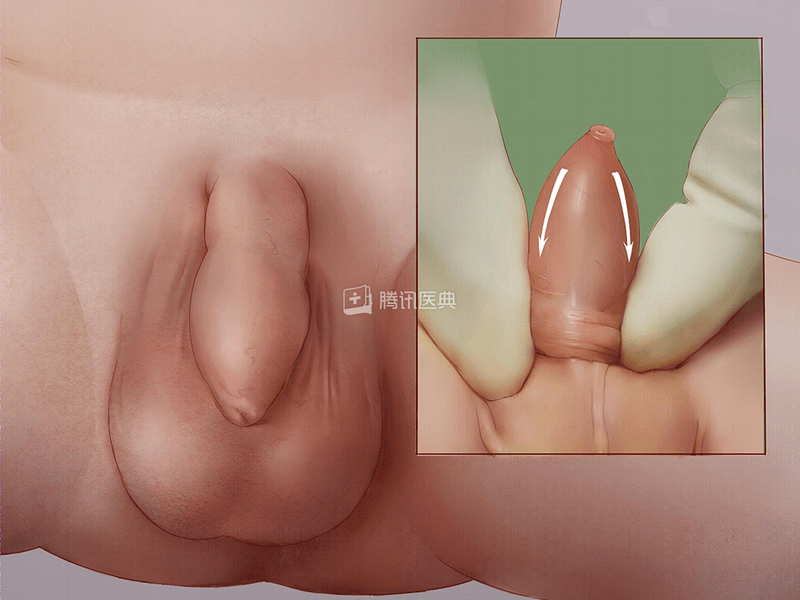 圖文圖片