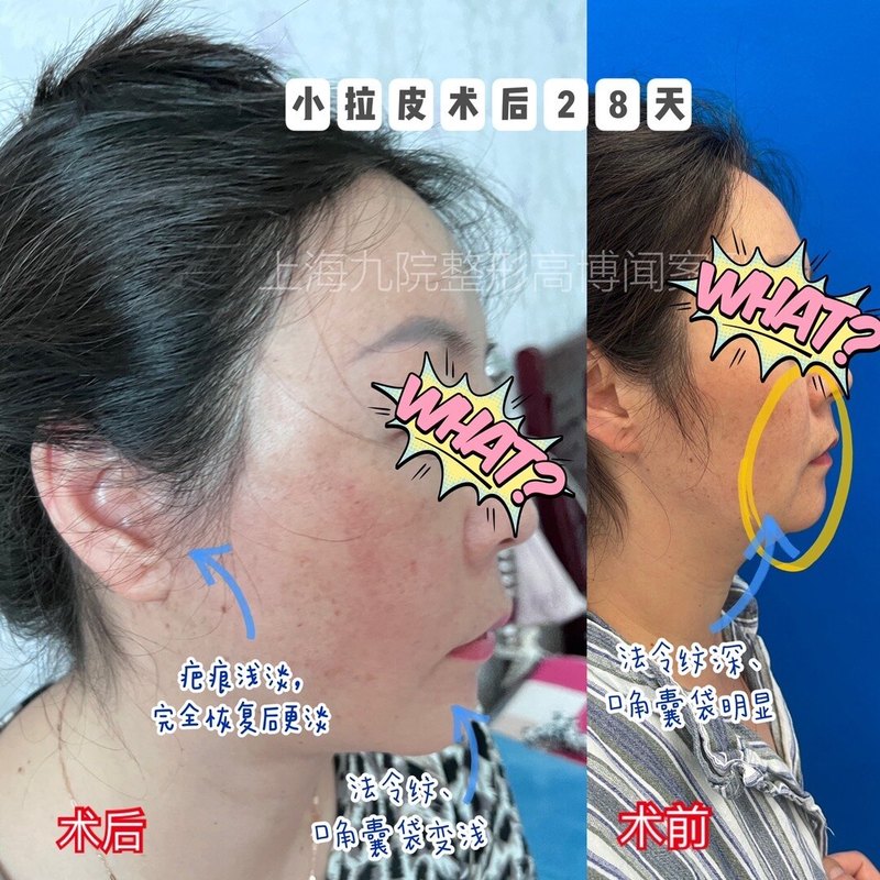 圖文圖片
