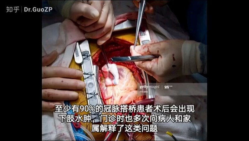 視頻封面