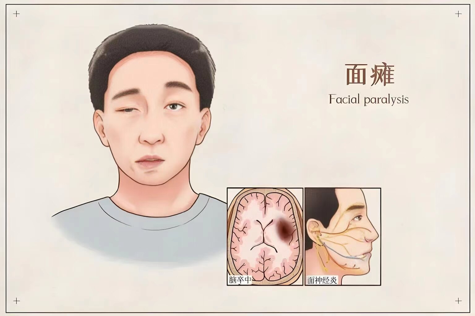 圖文圖片