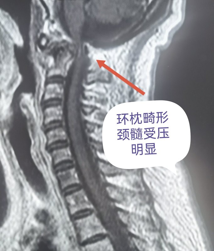 圖文圖片