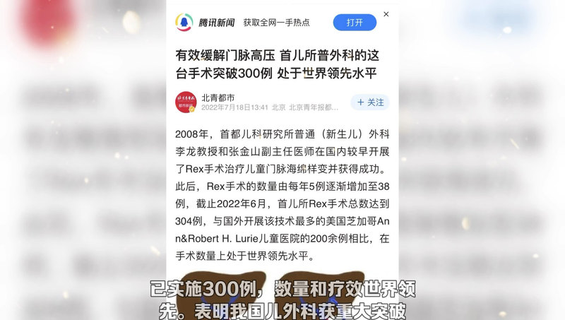 Rex手术治疗门脉高压获重大突破