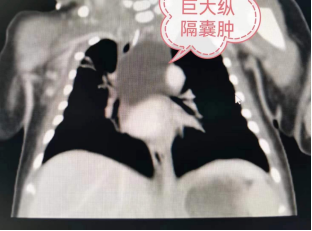 圖文圖片