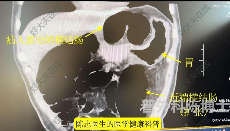 圖文圖片
