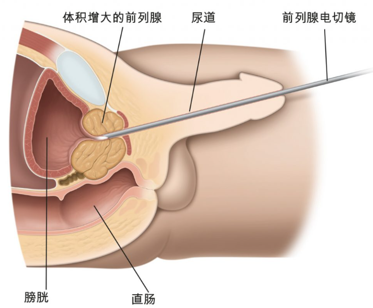 圖文圖片