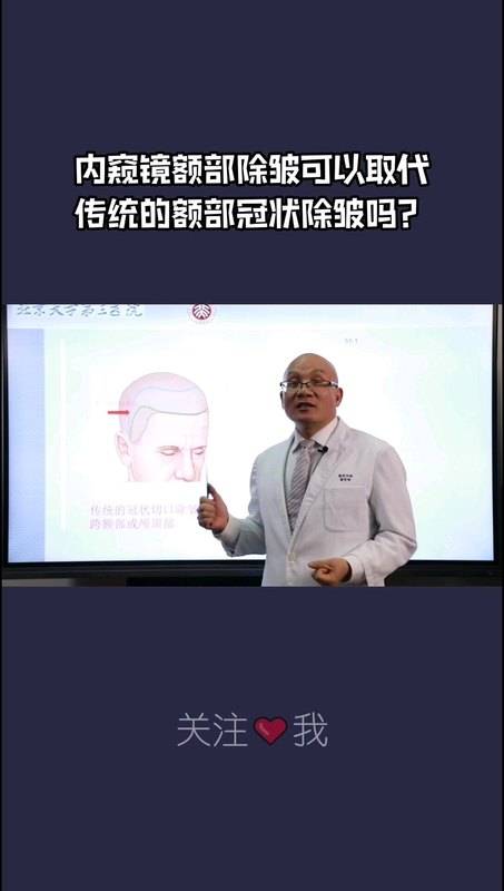 额部内窥镜除皱可以取代传统额部冠状除皱吗？