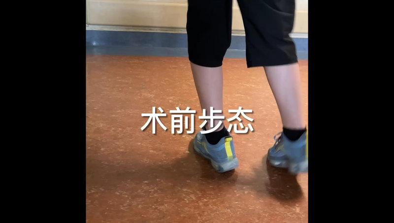 杜良杰教授团队：无金属内植物的肌腱转移技术，脑瘫后遗症，马蹄内翻足畸形，显微外科技术，术前术后对比