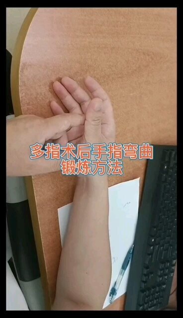 多指术后手指弯曲锻炼方法