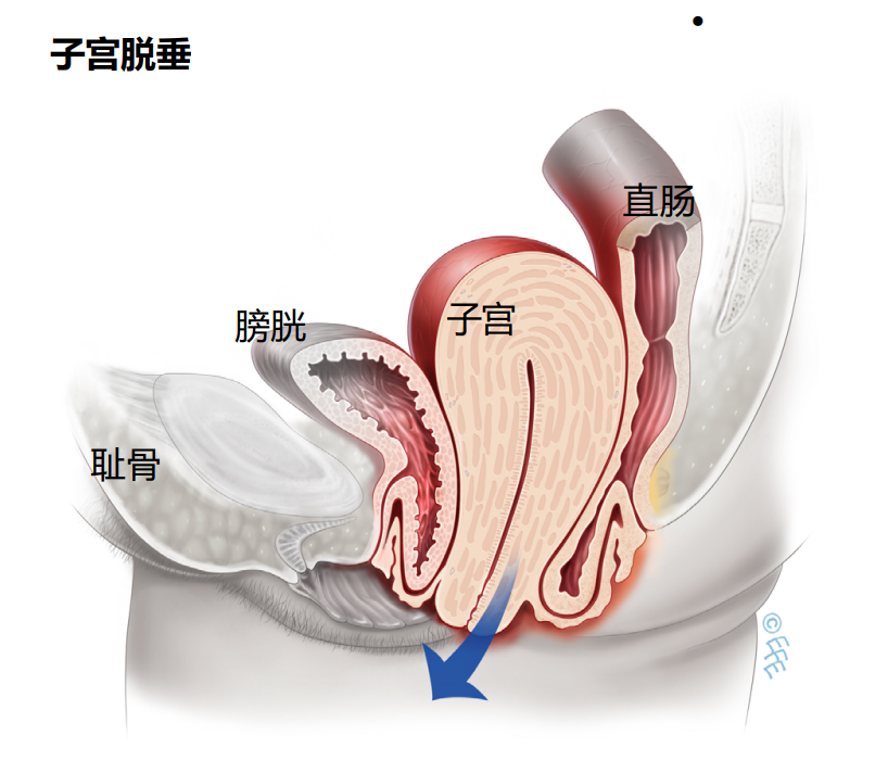 圖文圖片