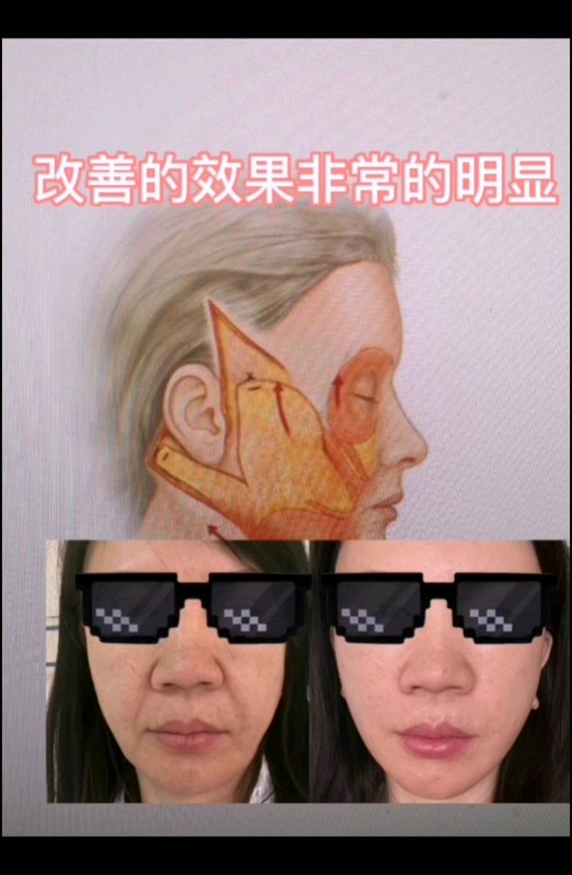 視頻封面