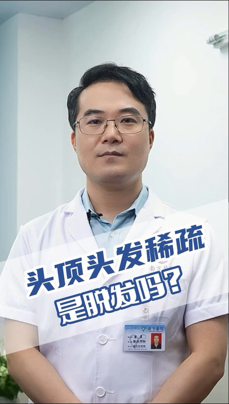 头顶头发稀疏是脱发吗？