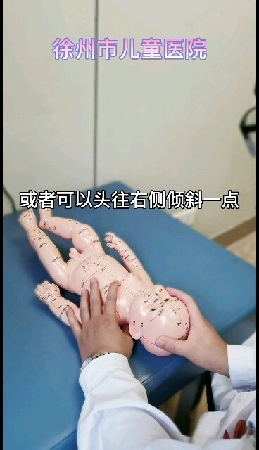小儿左侧肌性斜颈家庭睡姿