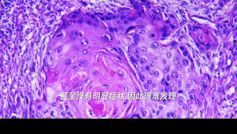 視頻封面