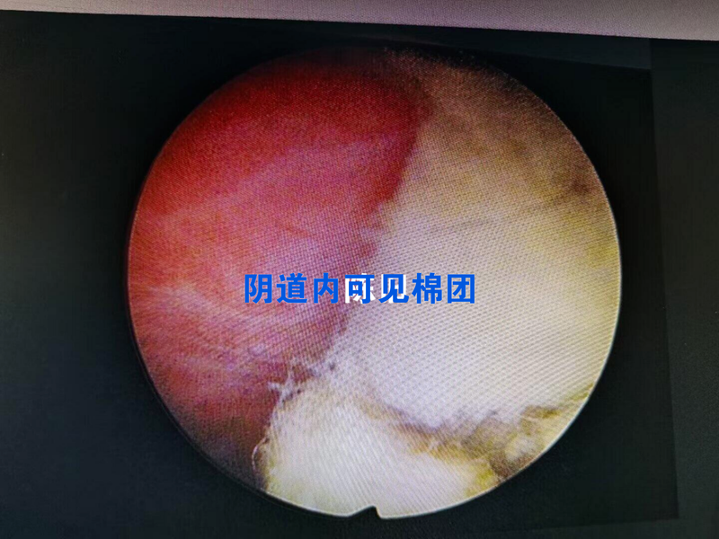 圖文圖片