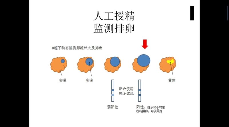 人工授精的流程