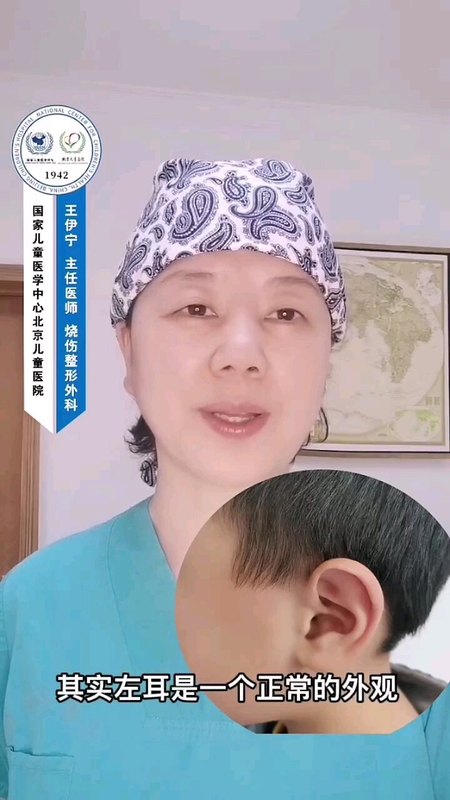 外耳畸形之猿耳畸形