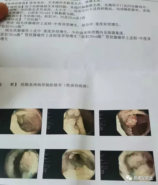 圖文圖片